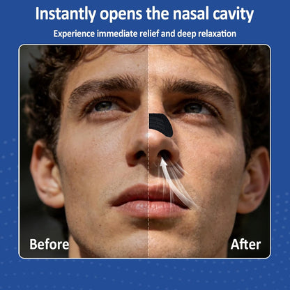 Nasal Strips for Snoring, Extra Strength Nose Strips for Breathing (60 Ct)